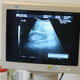 Image for article titled Law Forcing Abortion Seekers to Have Vaginal Probe Totally OK Since They've Already Been Penetrated